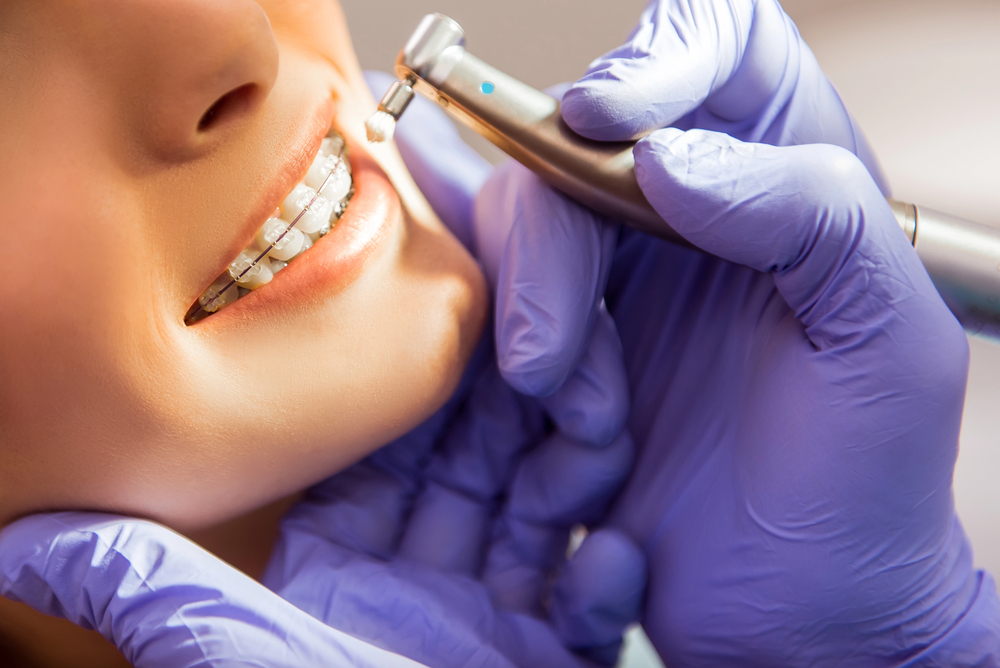 How Technology is Making Orthodontic Treatment More Lifestyle-Friendly