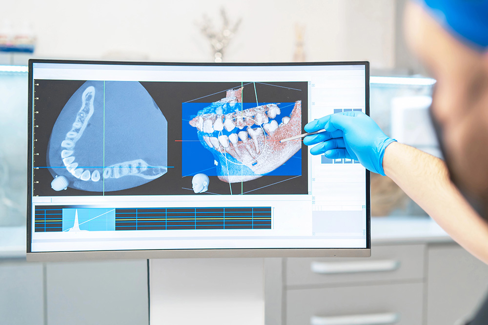 digital smile design